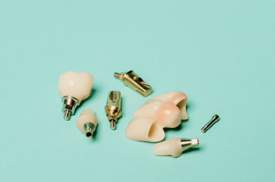 dental lab implant restorations